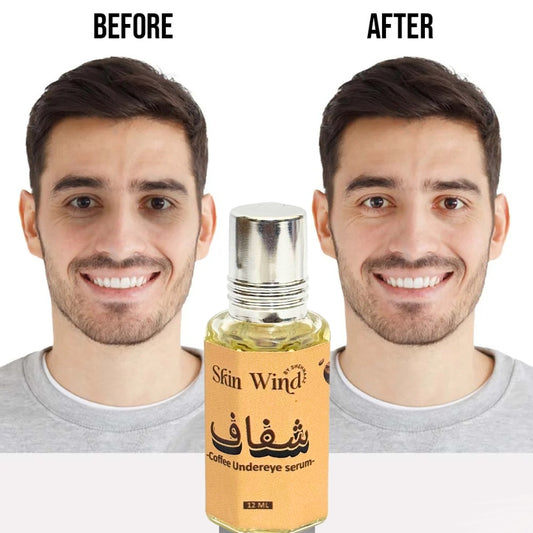 Shafaf Coffee Dark Circle Serum