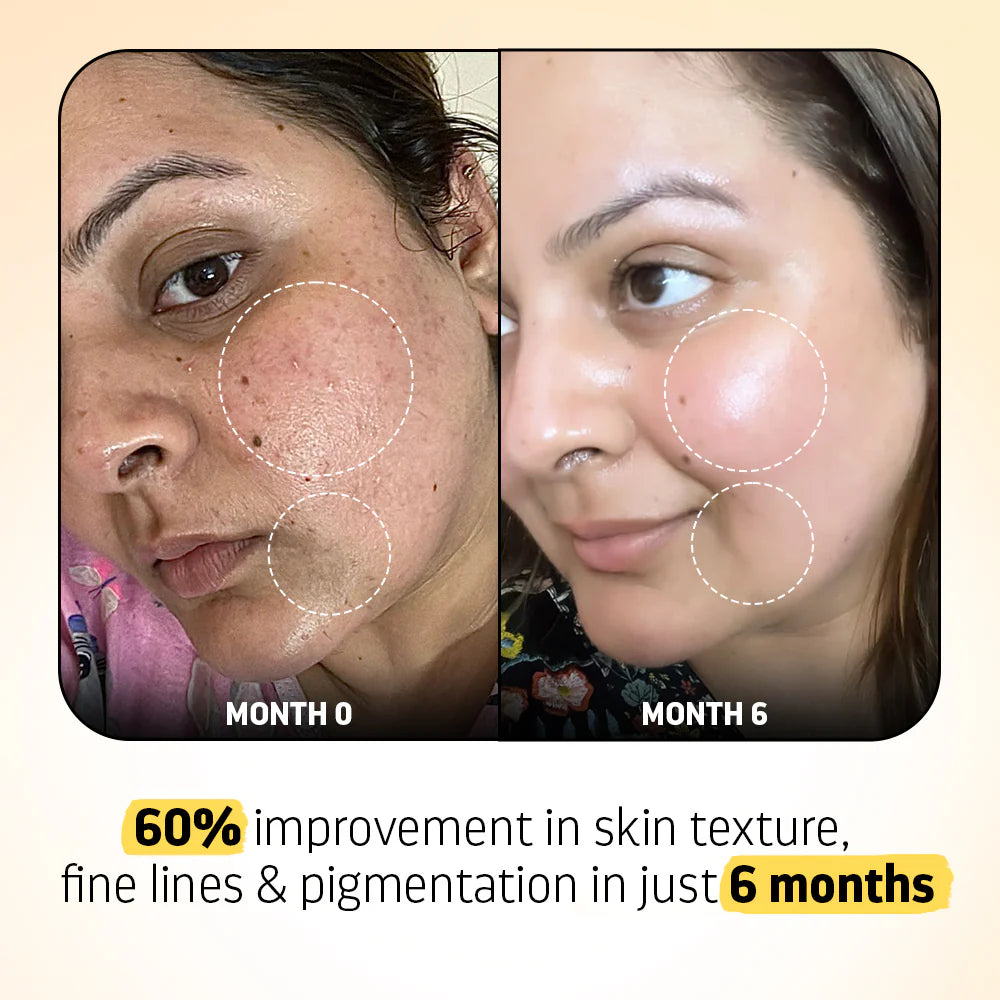 Advance Retinol Serum with Vitamin C & E