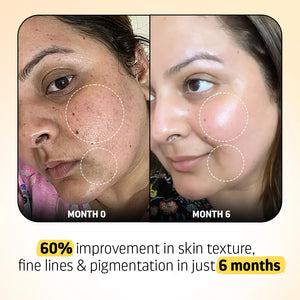 Retinol Serum (DERMATOLOGICALLY APPROVED)