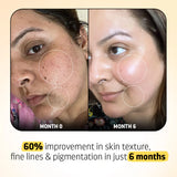 Retinol Serum (DERMATOLOGICALLY APPROVED)